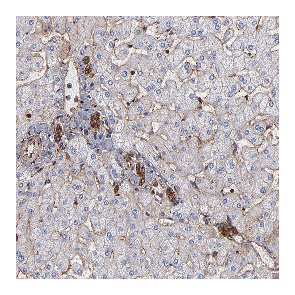 Atlas Antibodies Anti-ACTN4 Antibody