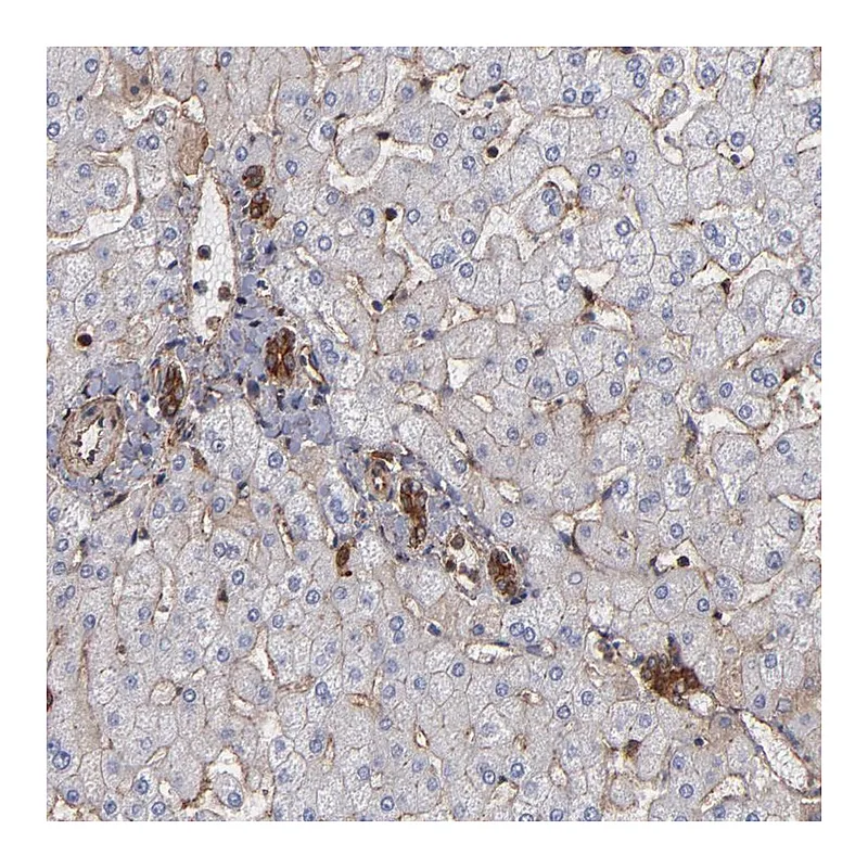 Atlas Antibodies Anti-ACTN4 Antibody