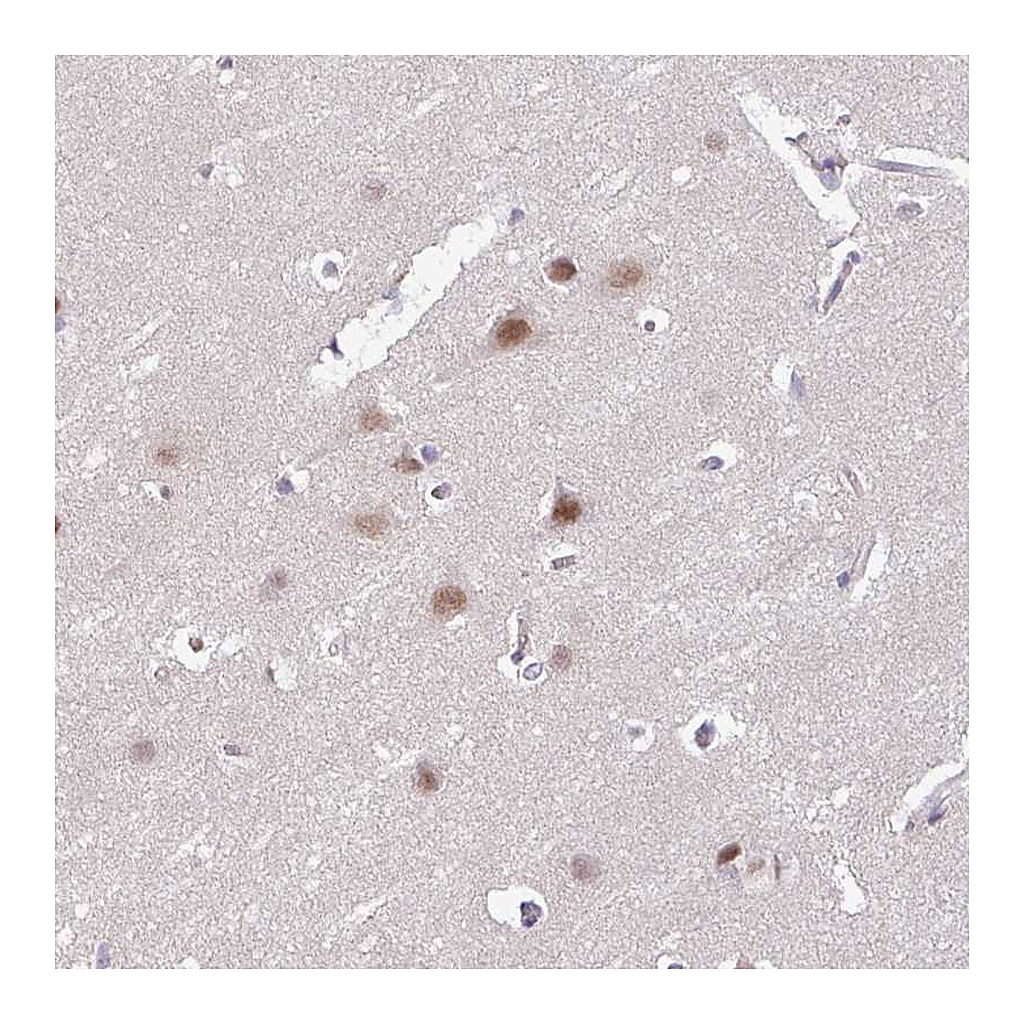 Atlas Antibodies Anti-ACTR3 Antibody