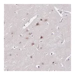 Atlas Antibodies Anti-ACTR3 Antibody