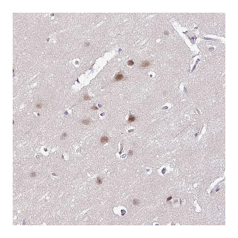 Atlas Antibodies Anti-ACTR3 Antibody
