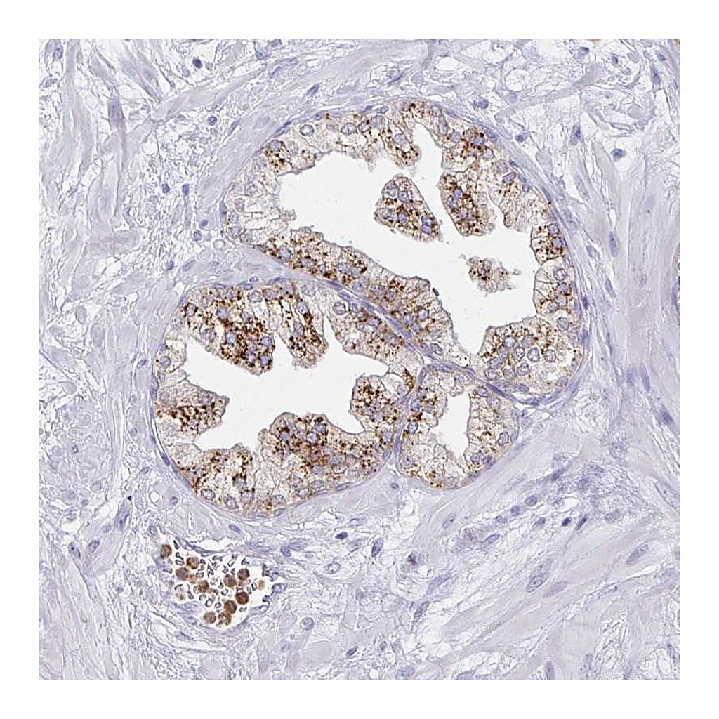 Atlas Antibodies Anti-ACTR3C Antibody