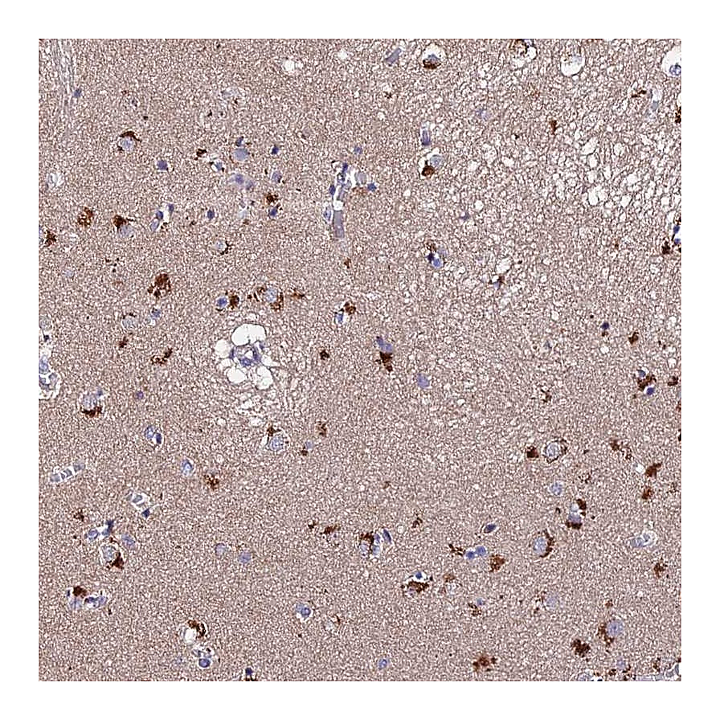 Atlas Antibodies Anti-ACTR5 Antibody