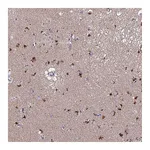 Atlas Antibodies Anti-ACTR5 Antibody