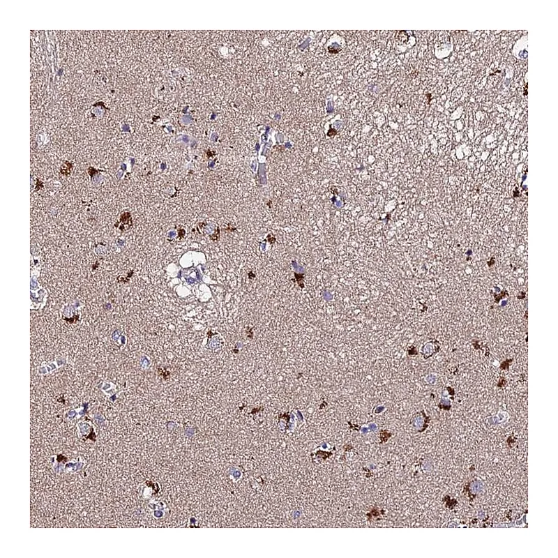 Atlas Antibodies Anti-ACTR5 Antibody