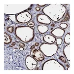 Atlas Antibodies Anti-ACTR6 Antibody