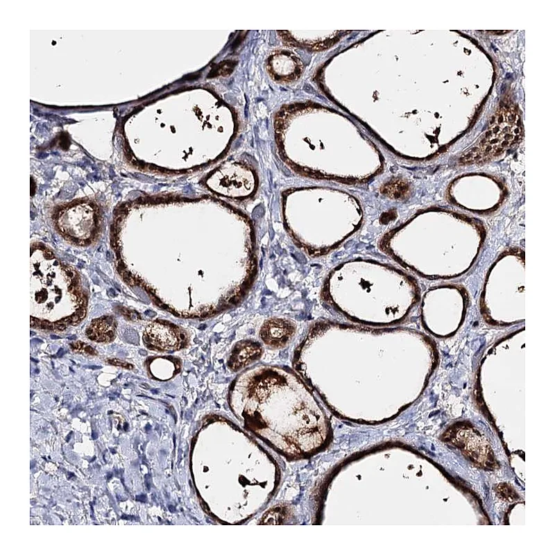 Atlas Antibodies Anti-ACTR6 Antibody