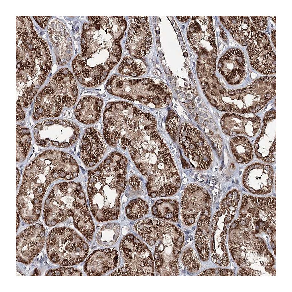 Atlas Antibodies Anti-ACTR6 Antibody