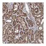 Atlas Antibodies Anti-ACTR6 Antibody