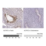 Atlas Antibodies Anti-ACTRT2 Antibody