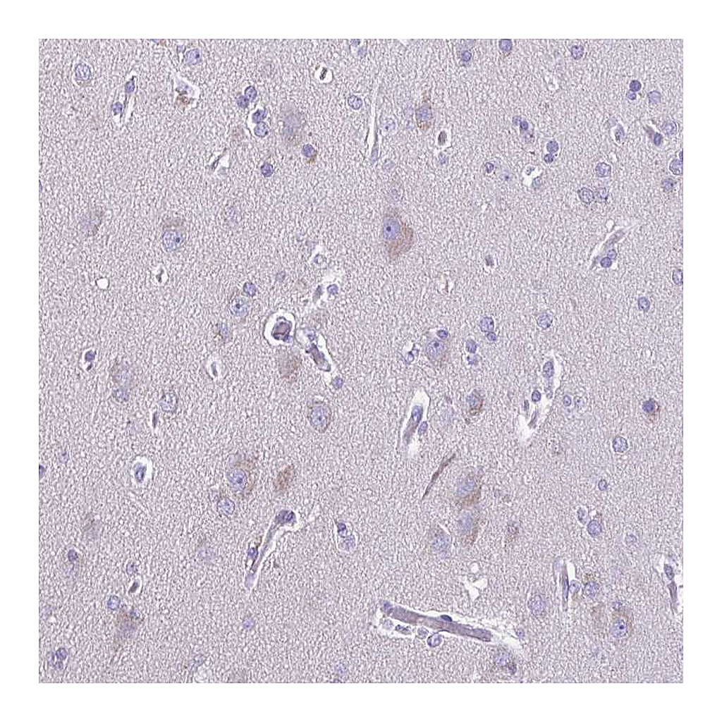 Atlas Antibodies Anti-ACTRT3 Antibody