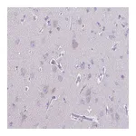 Atlas Antibodies Anti-ACTRT3 Antibody