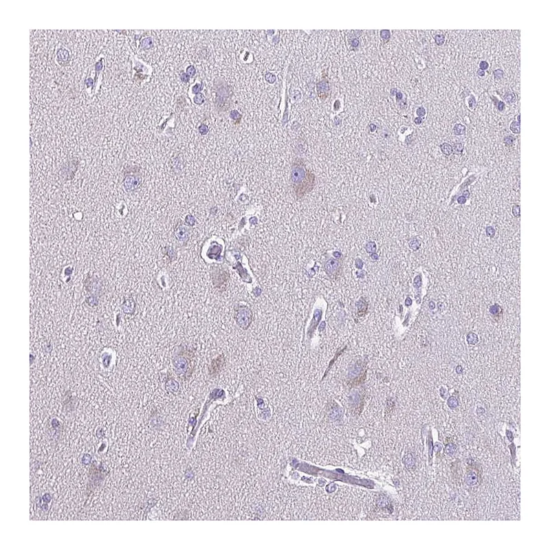 Atlas Antibodies Anti-ACTRT3 Antibody