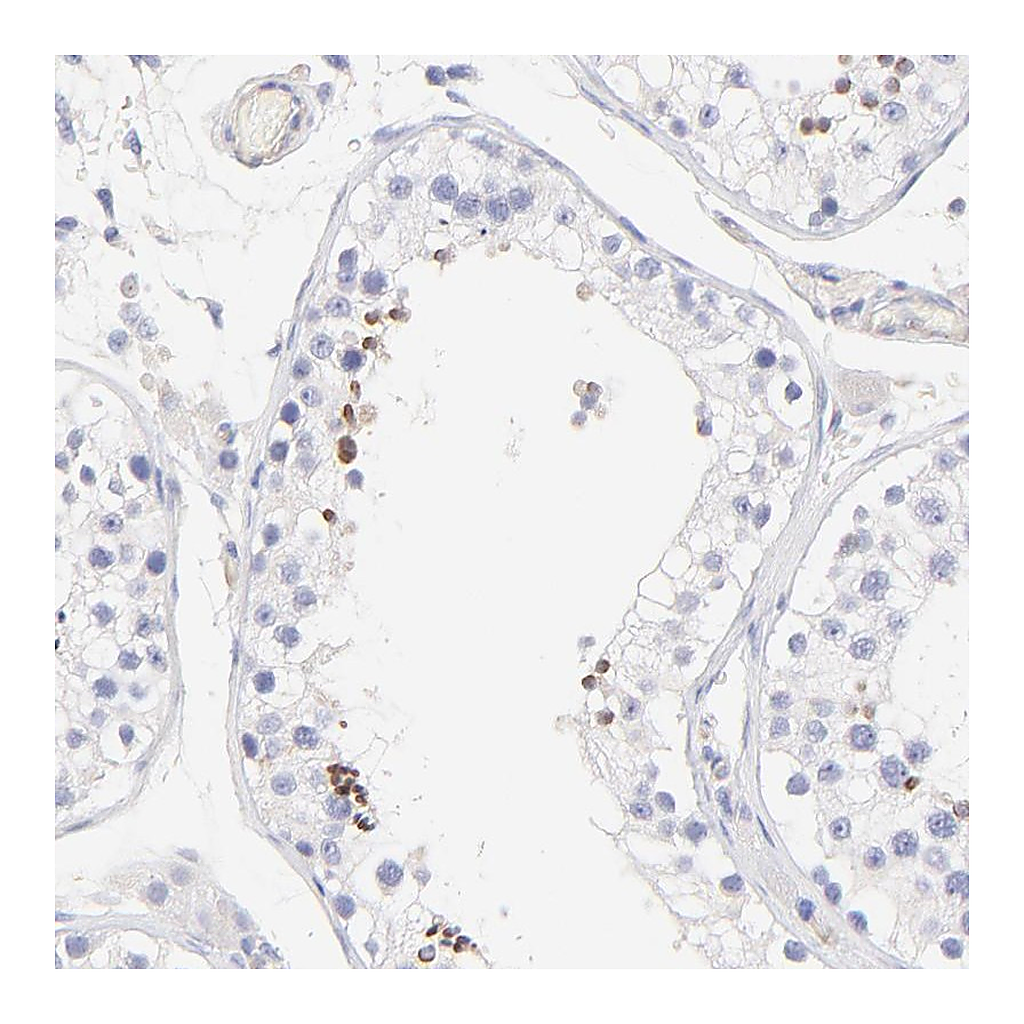 Atlas Antibodies Anti-ACTRT1 Antibody