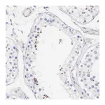 Atlas Antibodies Anti-ACTRT1 Antibody