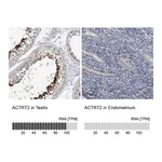 Atlas Antibodies Anti-ACTRT2 Antibody