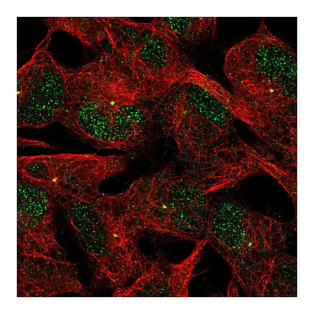 Atlas Antibodies Anti-ACTR8 Antibody