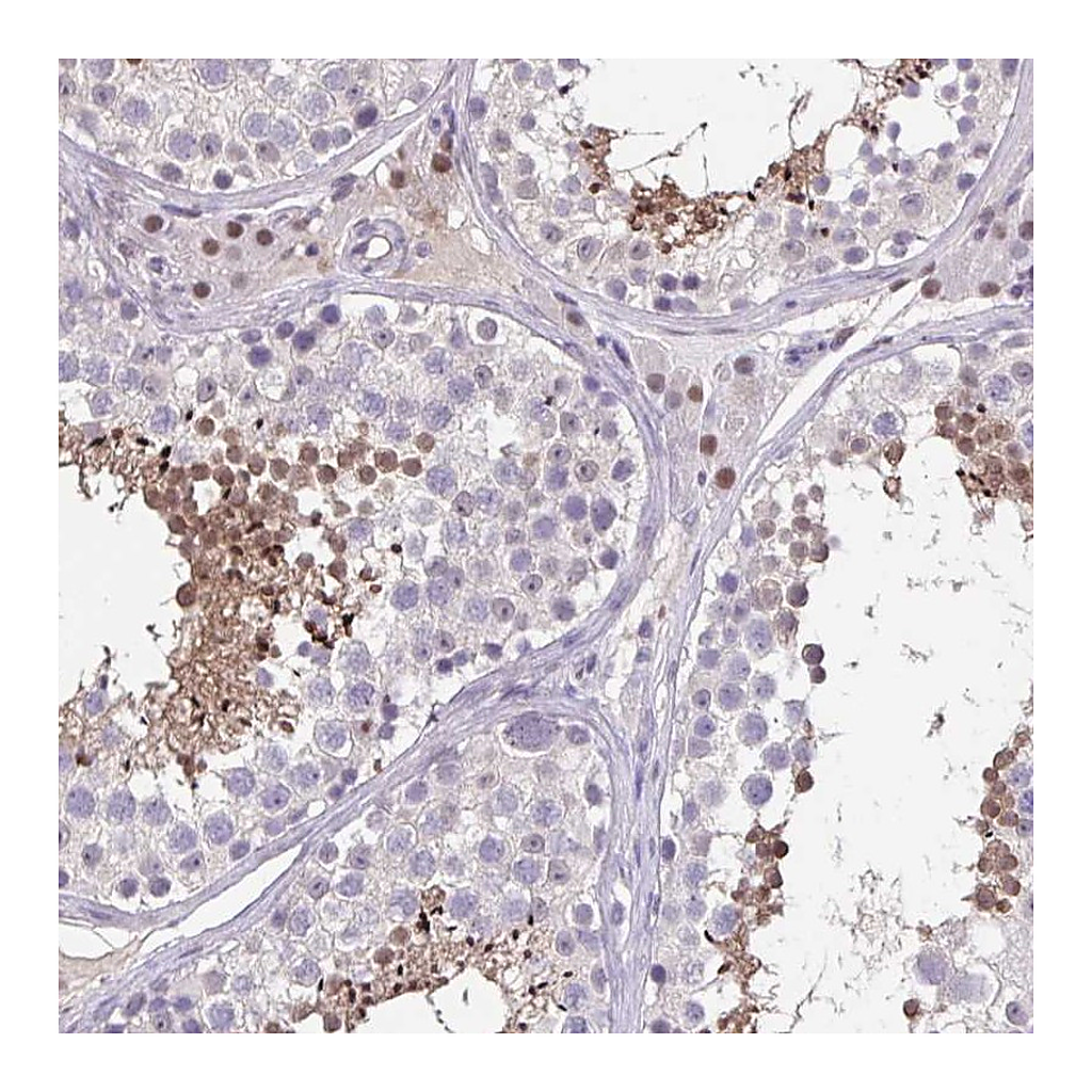 Atlas Antibodies Anti-ACTRT3 Antibody