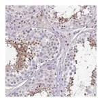Atlas Antibodies Anti-ACTRT3 Antibody