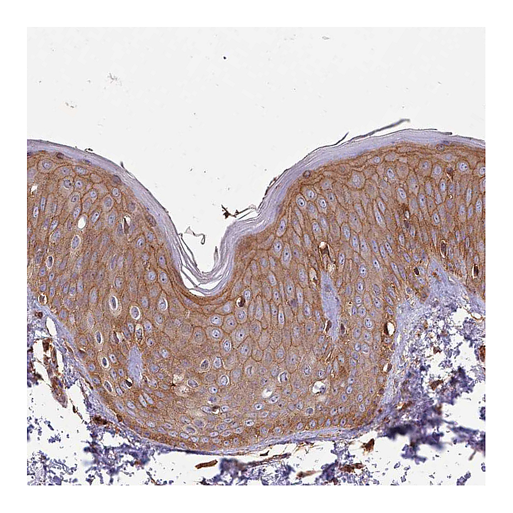 Atlas Antibodies Anti-ACVR2A Antibody