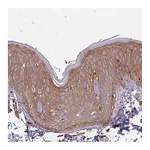 Atlas Antibodies Anti-ACVR2A Antibody