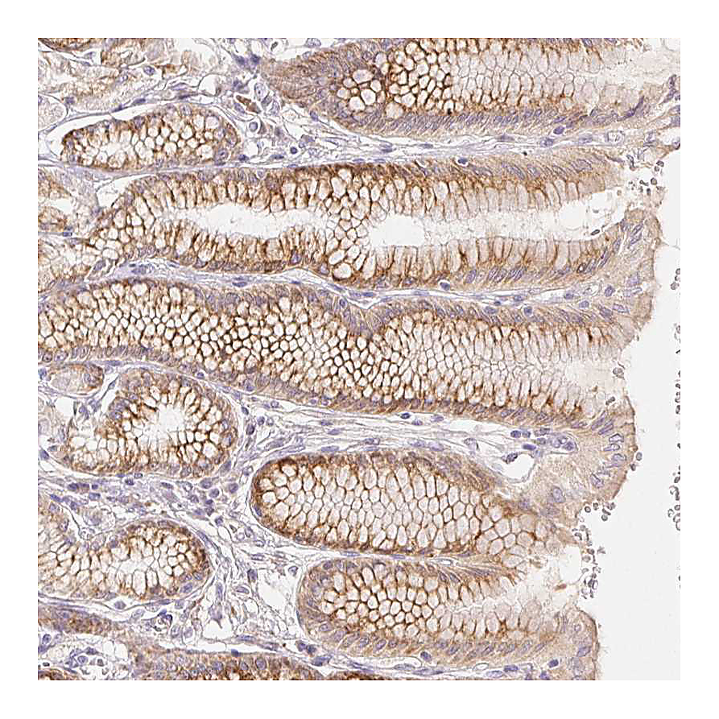Atlas Antibodies Anti-ACVR1B Antibody