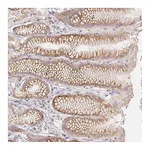 Atlas Antibodies Anti-ACVR1B Antibody