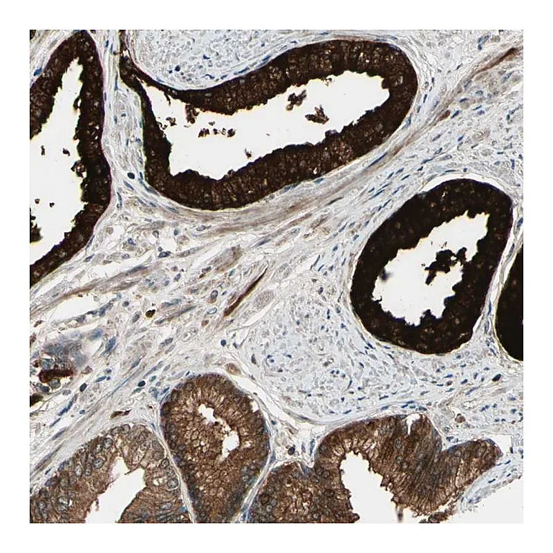 Atlas Antibodies Anti-ACVR1C Antibody