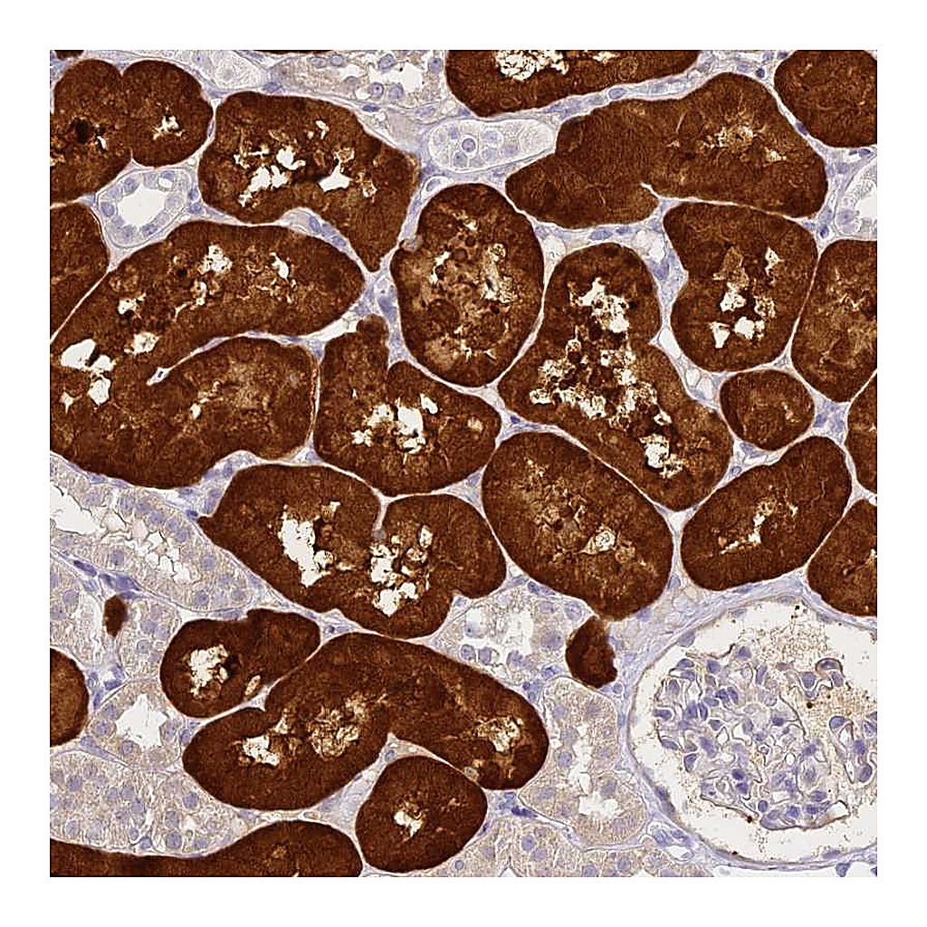 Atlas Antibodies Anti-ACY1 Antibody