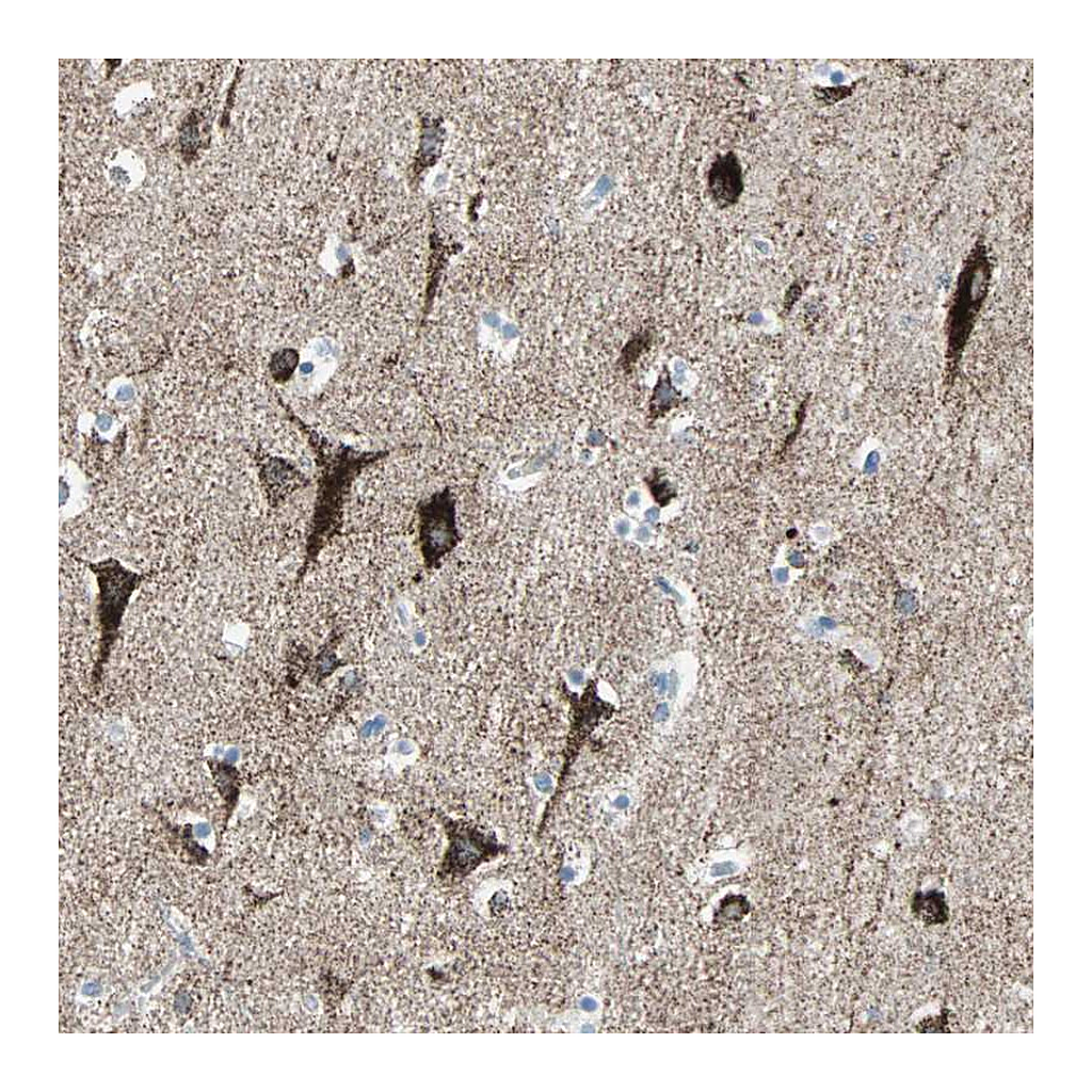 Atlas Antibodies Anti-ACVRL1 Antibody