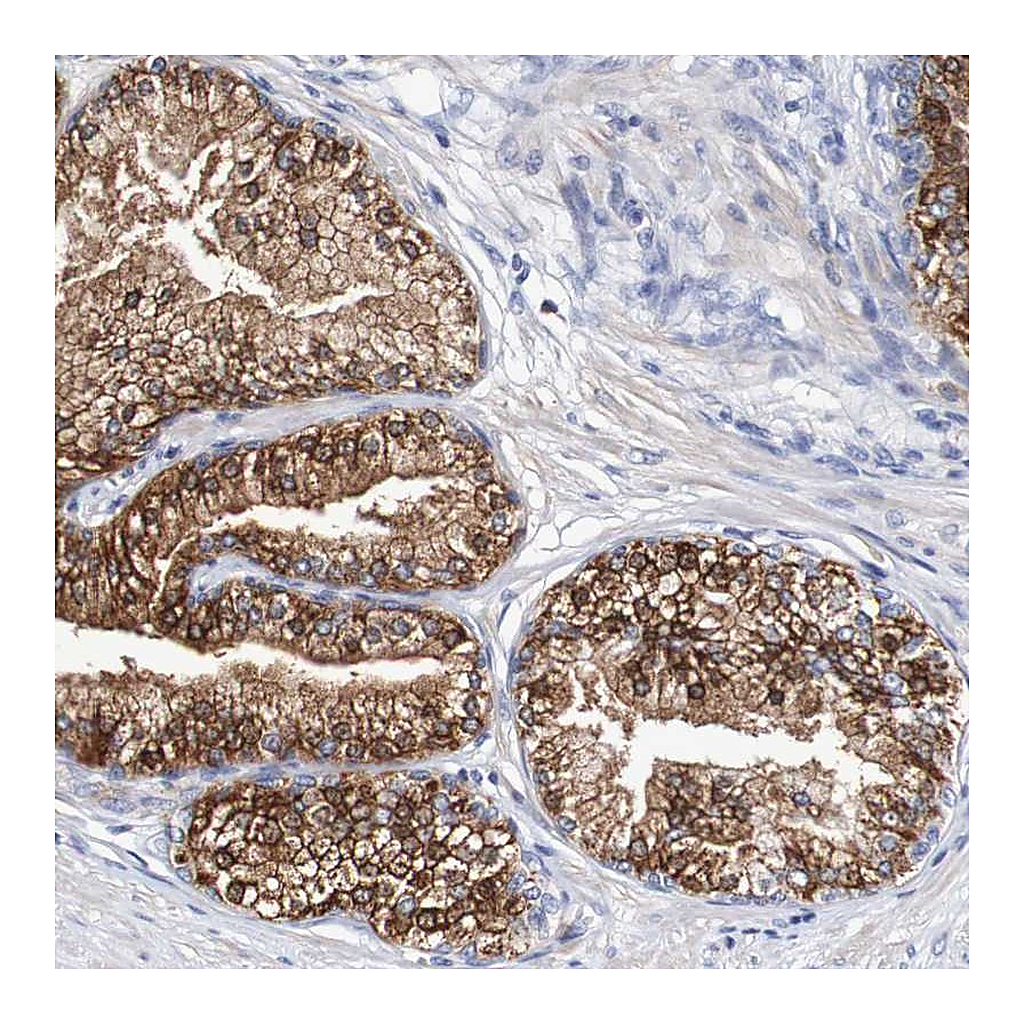 Atlas Antibodies Anti-ACVR1C Antibody