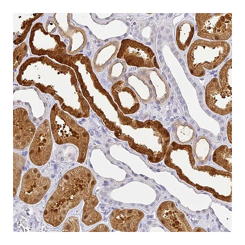 Atlas Antibodies Anti-ACY1 Antibody
