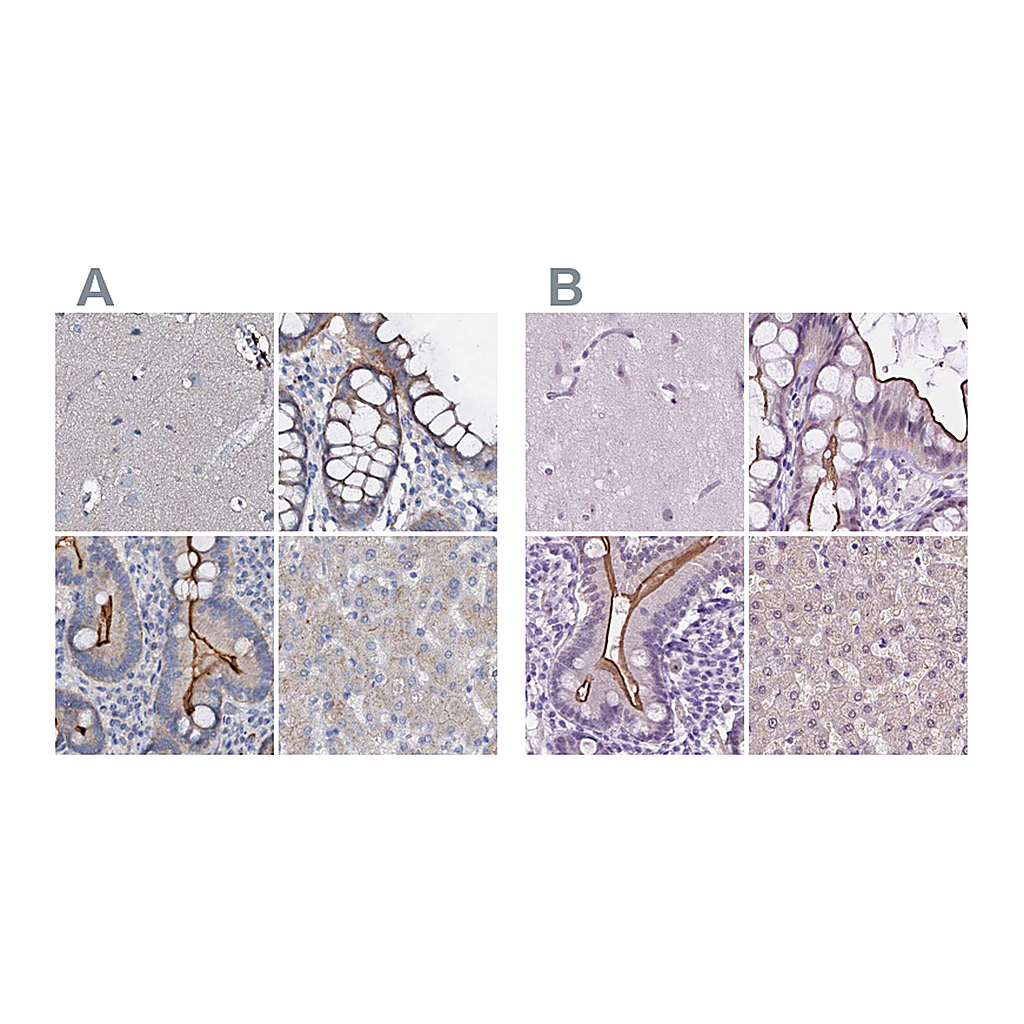 Atlas Antibodies Anti-ACY3 Antibody