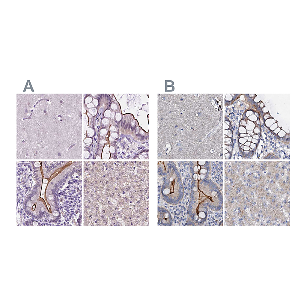 Atlas Antibodies Anti-ACY3 Antibody