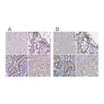 Atlas Antibodies Anti-ACY3 Antibody