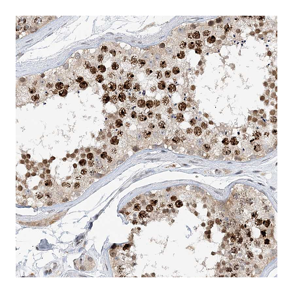 Atlas Antibodies Anti-ACYP2 Antibody