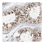 Atlas Antibodies Anti-ACYP2 Antibody