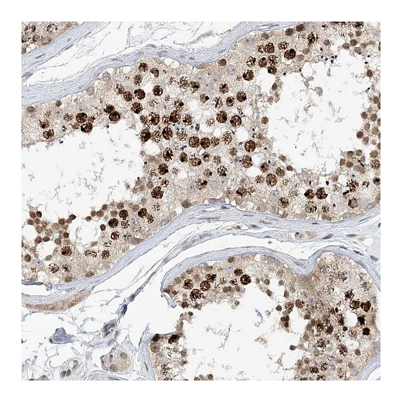 Atlas Antibodies Anti-ACYP2 Antibody