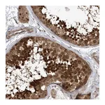 Atlas Antibodies Anti-ACYP1 Antibody