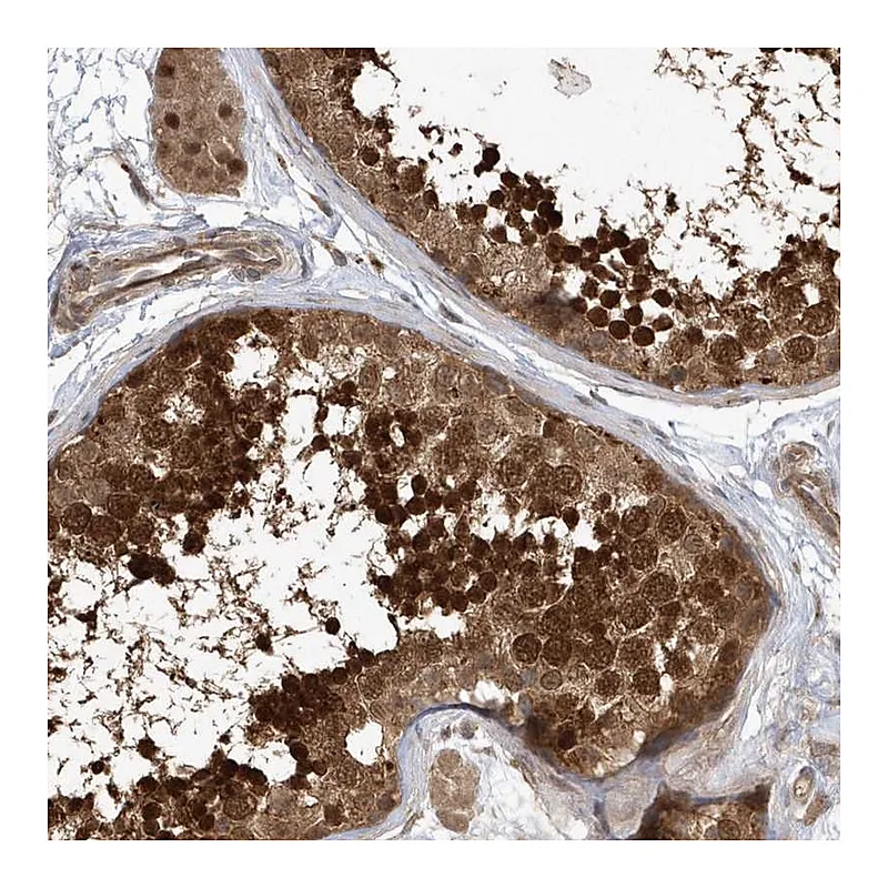 Atlas Antibodies Anti-ACYP1 Antibody