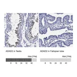 Atlas Antibodies Anti-ADAD2 Antibody