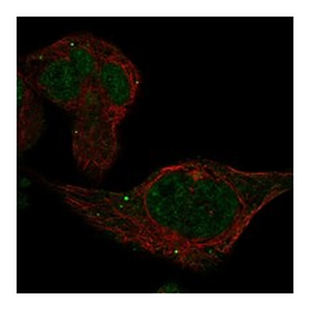 Atlas Antibodies Anti-ADAL Antibody