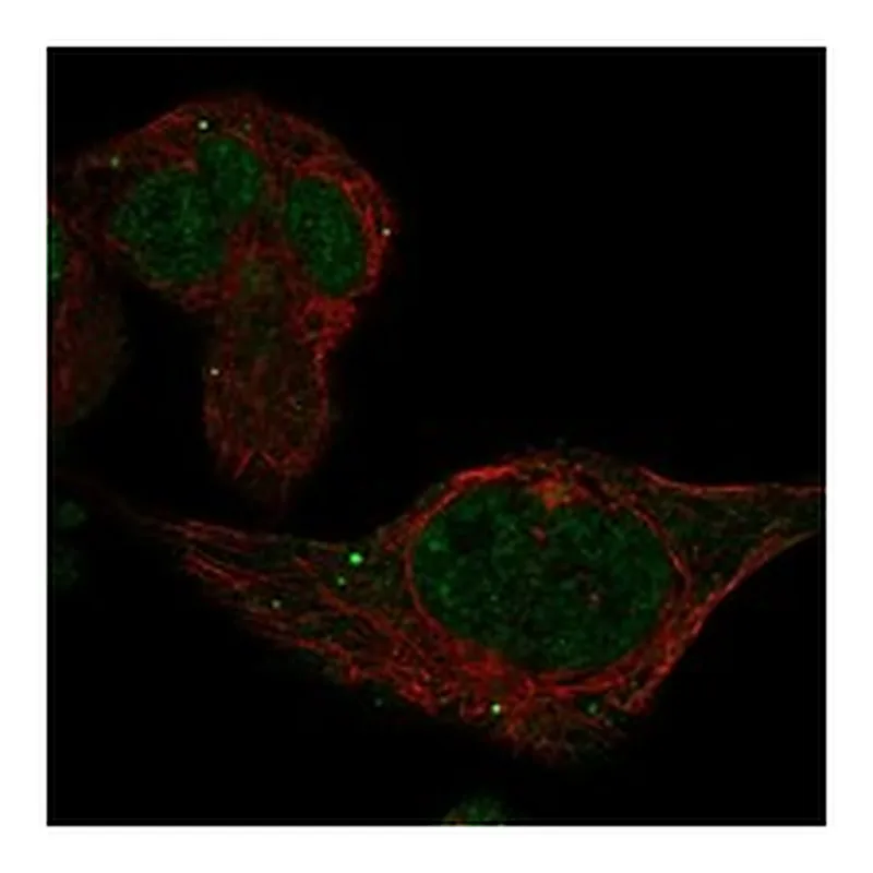 Atlas Antibodies Anti-ADAL Antibody