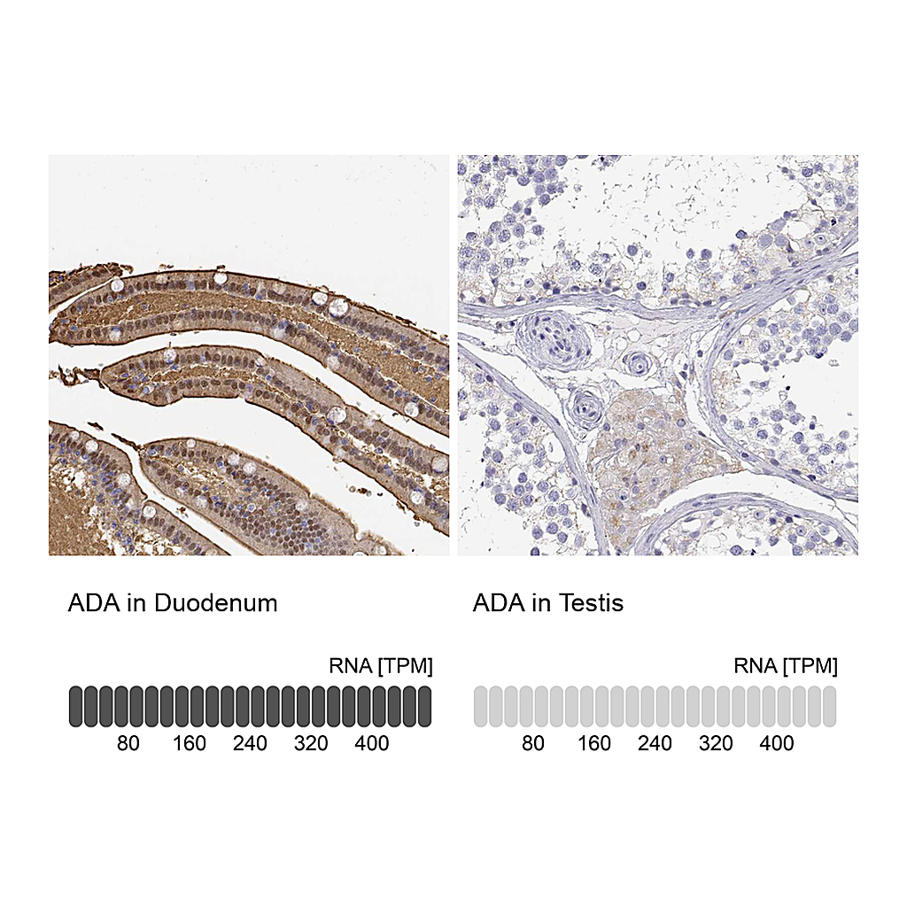 Atlas Antibodies Anti-ADA Antibody