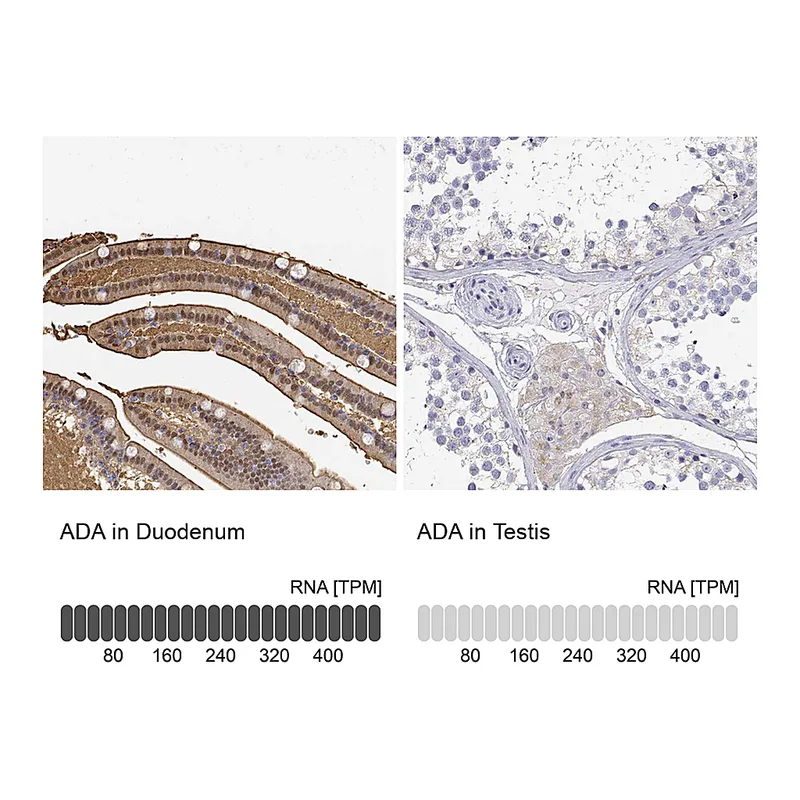 Atlas Antibodies Anti-ADA Antibody