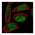 Atlas Antibodies Anti-ADAL Antibody