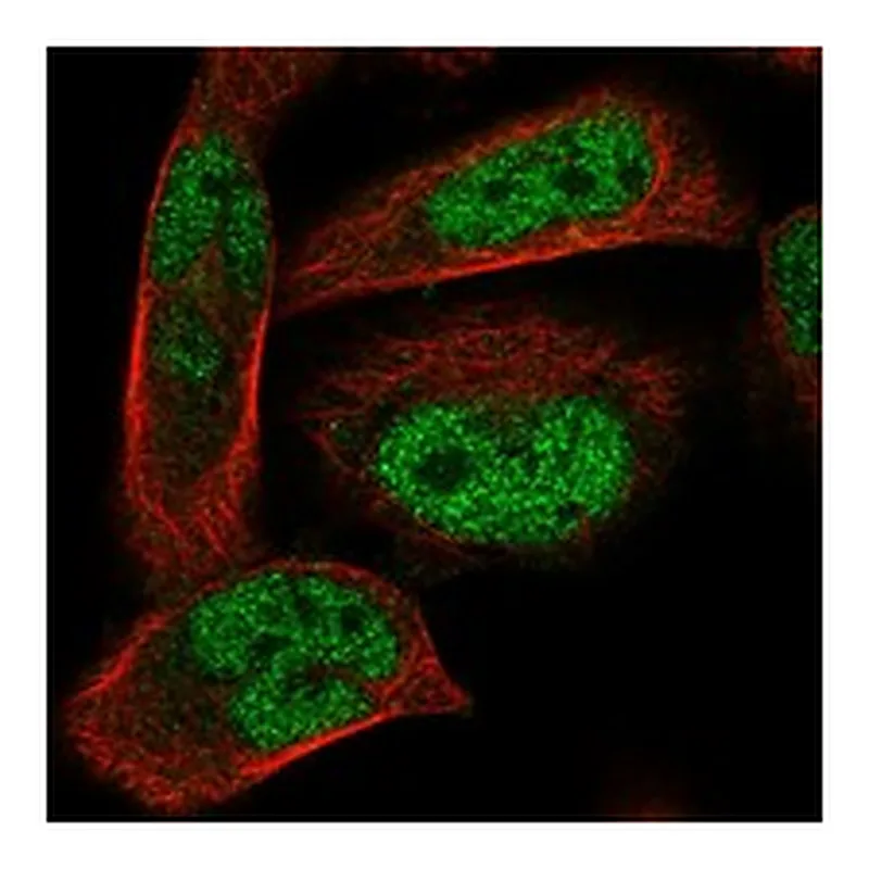 Atlas Antibodies Anti-ADAL Antibody