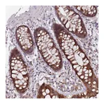 Atlas Antibodies Anti-ADAL Antibody