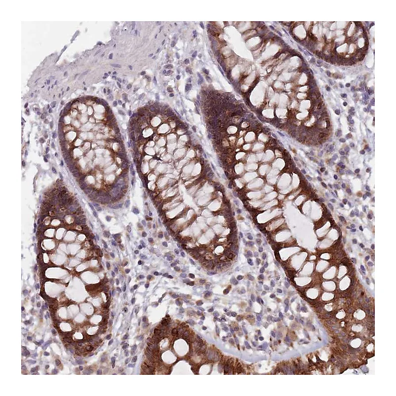 Atlas Antibodies Anti-ADAL Antibody