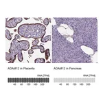 Atlas Antibodies Anti-ADAM12 Antibody